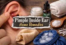 Pimple Inside Ear Home Remedies: 9 Brutally Honest Ways I Tried (Some Worked, Some Backfired)