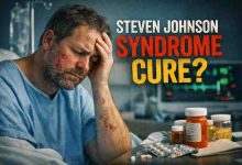 Steven Johnson Syndrome Cure: 7 Hard Truths I Learned the Scary Way 😬