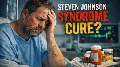 Steven Johnson Syndrome Cure: 7 Hard Truths I Learned the Scary Way 😬