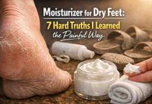 Moisturizer for Dry Feet 7 Hard Truths I Learned the Painful Way