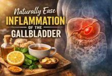 Naturally Ease Inflammation of the Gallbladder: 9 Things I Tried When My Side Felt Like It Was on Fire