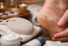 Pumice Stone for Cracked Heels 9 Hard Lessons People Learn Before They Finally See Relief