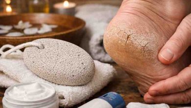 Pumice Stone for Cracked Heels 9 Hard Lessons People Learn Before They Finally See Relief