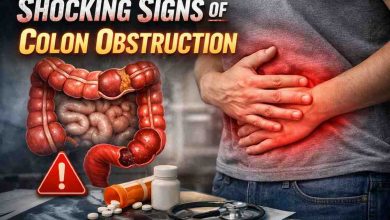Shocking Signs of Colon Obstruction: 11 Warnings That Honestly Freaked Me Out 6 Shocking Signs of Colon Obstruction