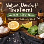Natural Remedies For Dandruff Treatment 1
