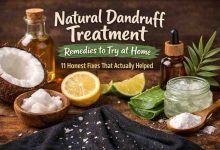 Natural dandruff treatment remedies to try at home: 11 honest fixes that actually helped (after years of frustration)