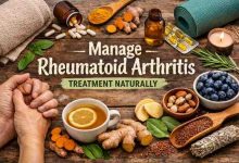 Manage Rheumatoid Arthritis Treatment Naturally: 9 Things That Finally Made My Body Stop Screaming