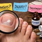 White Marks on Toenails 9 Real Causes Frustration What Actually Brings Relief