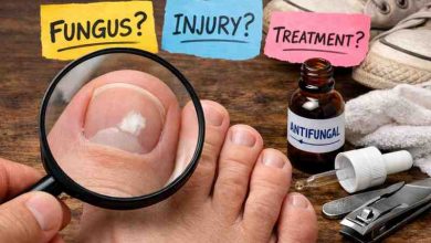 White Marks on Toenails: 9 Real Causes, Frustration & What Actually Brings Relief 8 White Marks on Toenails 9 Real Causes Frustration What Actually Brings Relief