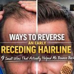 Ways To Reverse An Early Receding Hairline 9 Small Wins That Actually Helped Me Bounce Back 1