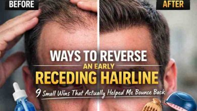 Ways to Reverse an Early Receding Hairline: 9 Small Wins That Actually Helped Me Bounce Back