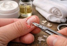 Broken Skin Around Nails 9 Frustrating Causes Ive Seen and What Actually Helps