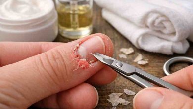 Broken Skin Around Nails 9 Frustrating Causes Ive Seen and What Actually Helps