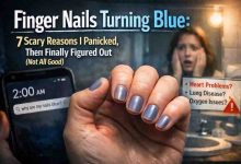Finger Nails Turning Blue 7 Scary Reasons I Panicked Then Finally Figured Out Not All Good