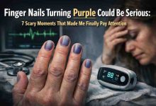 Finger Nails Turning Purple Could Be Serious 7 Scary Moments That Made Me Finally Pay Attention