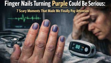 Finger Nails Turning Purple Could Be Serious 7 Scary Moments That Made Me Finally Pay Attention