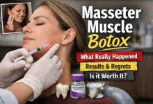 Masseter muscle botox 7 hard truths real relief and one warning I wish Id heard sooner
