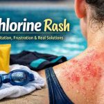 Chlorine Rash 9 Hard Truths Ive Seen After Watching So Many Swimmers Deal With It 1