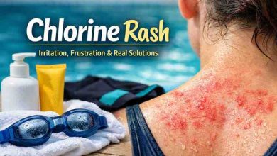 chlorine rash 9 hard truths ive seen after watching so many swimmers deal with it