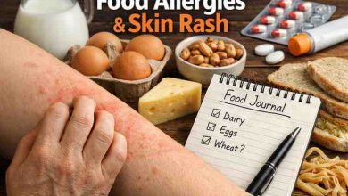 food allergies skin rash 9 frustrating patterns ive watched people miss before finally finding relief