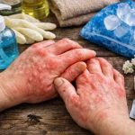 hands are itching and swelling 11 real causes most people miss and the relief that finally works