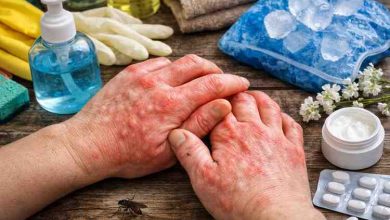 hands are itching and swelling 11 real causes most people miss and the relief that finally works