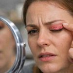 skin rash on eyelid 9 frustrating causes i keep seeing and what actually brings relief