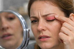 skin rash on eyelid 9 frustrating causes i keep seeing and what actually brings relief
