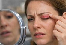 skin rash on eyelid 9 frustrating causes i keep seeing and what actually brings relief