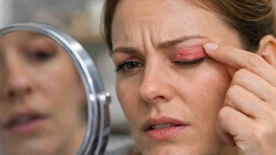 skin rash on eyelid 9 frustrating causes i keep seeing and what actually brings relief