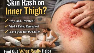 skin rash on inner thigh 11 frustrating causes i keep seeing and what actually brings relief
