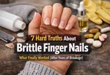 7 Hard Truths About Brittle Finger Nails That Finally Helped