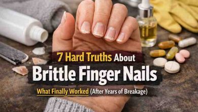 7 Hard Truths About Brittle Finger Nails That Finally Helped