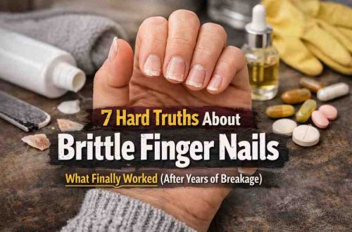 7 Hard Truths About Brittle Finger Nails That Finally Helped