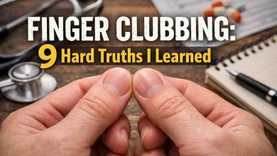 Finger Clubbing 9 Hard Truths I Learned the Uncomfortable Way