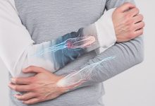 Why Your Forearms and Wrists Hurt — Causes Fixes and What Actually Helped Me Recover